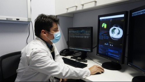 Posta Central detecta coronavirus en minutos con sistema de Inteligencia Artificial