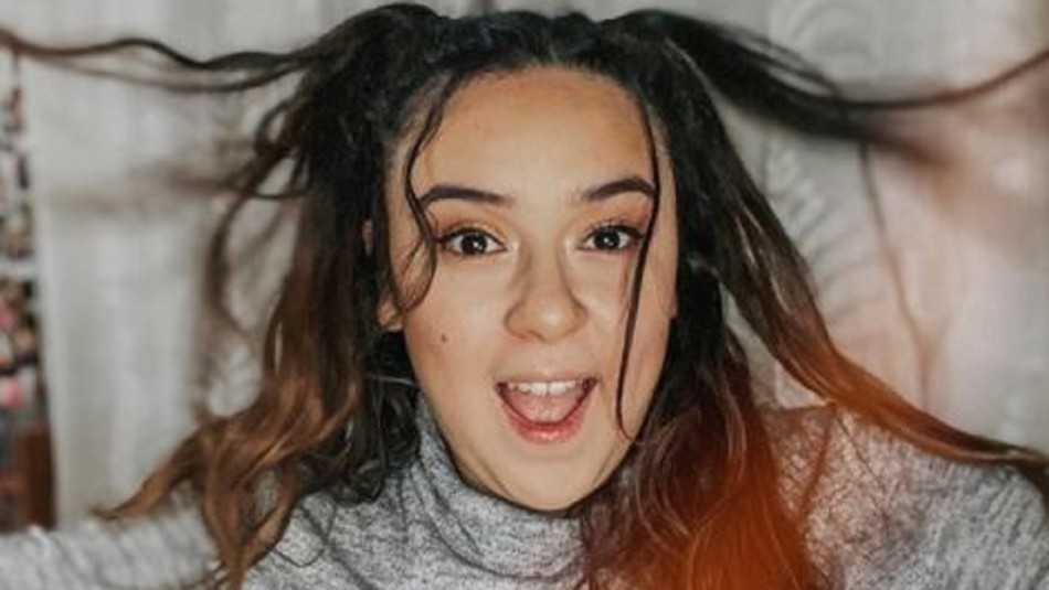 Christell Rodríguez muestra los resultados de su procedimiento estético