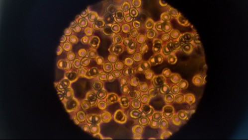 Malasia encuentra cepa de coronavirus diez veces más infecciosa