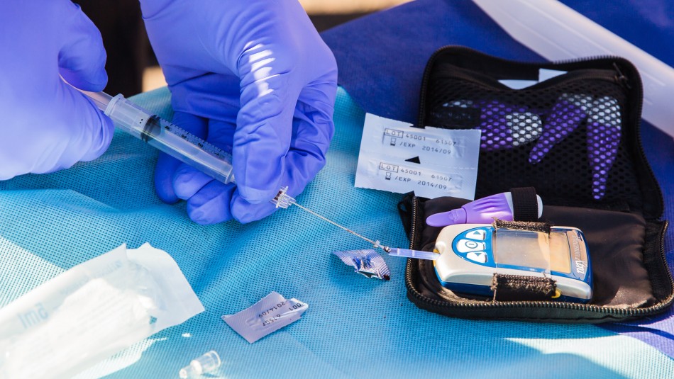 diabetes celulas madre Un tratamiento con células madre ofrece esperanzas a los diabéticos