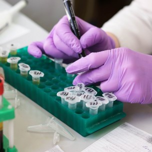 Investigadores de la UC aíslan cultivos de coronavirus para futuras investigaciones y vacunas