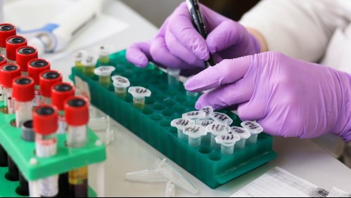 Investigadores de la UC aíslan cultivos de coronavirus para futuras investigaciones y vacunas