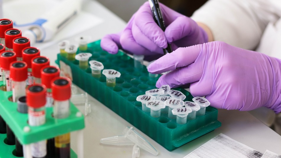 Investigadores de la UC aíslan cultivos de coronavirus para futuras investigaciones y vacunas Investigadores de la UC aíslan cultivos de coronavirus para futuras investigaciones y vacunas