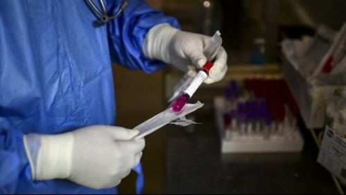 Argentina alcanza récord de contagios de coronavirus con más de 10.500 casos en un día