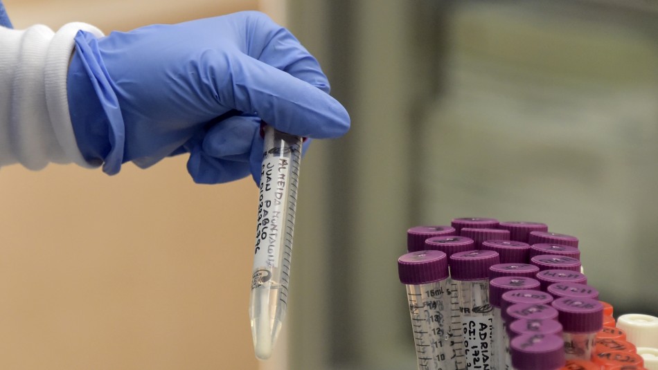 Confirman primer caso de reinfección por coronavirus en Ecuador Confirman primer caso de reinfección por coronavirus en Ecuador