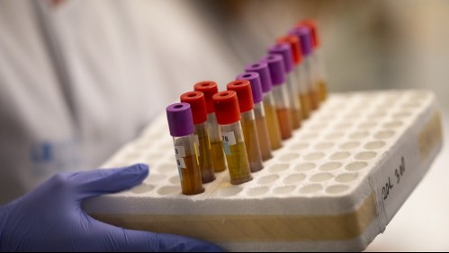 Prometedora vacuna de Oxford comenzaría sus ensayos en Chile a mediados de septiembre
