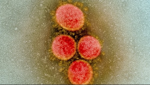 Vacuna chilena contra el coronavirus: Es desarrollada a partir de un 'clon'