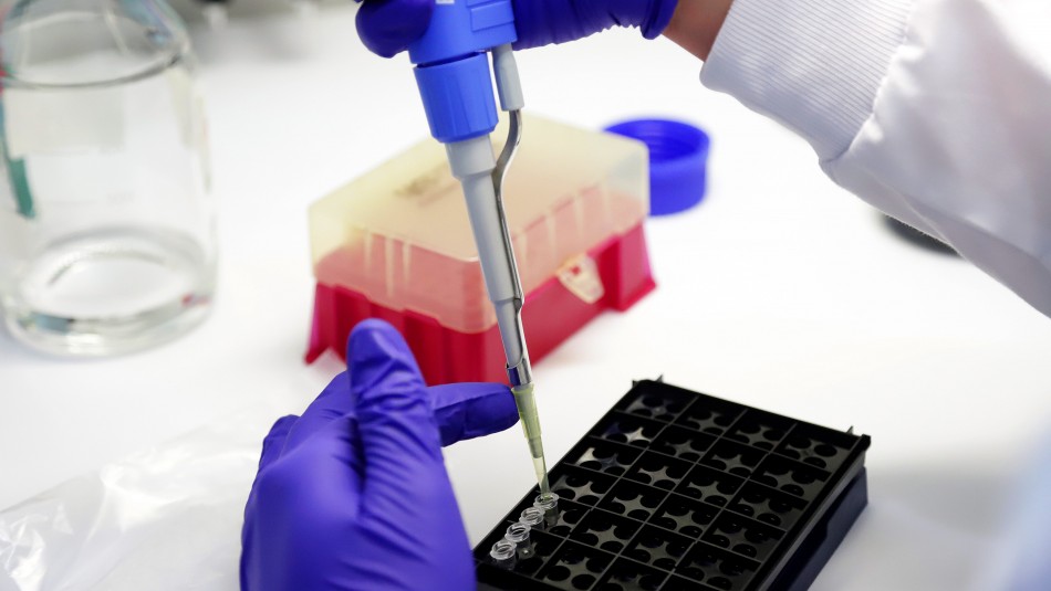 Grupo farmacéutico lanza un ensayo cuantitativo de anticuerpos contra el coronavirus Grupo farmacéutico lanza un ensayo cuantitativo de anticuerpos contra el coronavirus