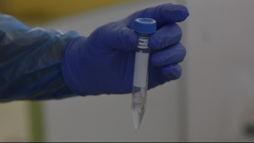 Espacio Público responde a Paris: Eligió 'la peor' interpretación del informe sobre test PCR