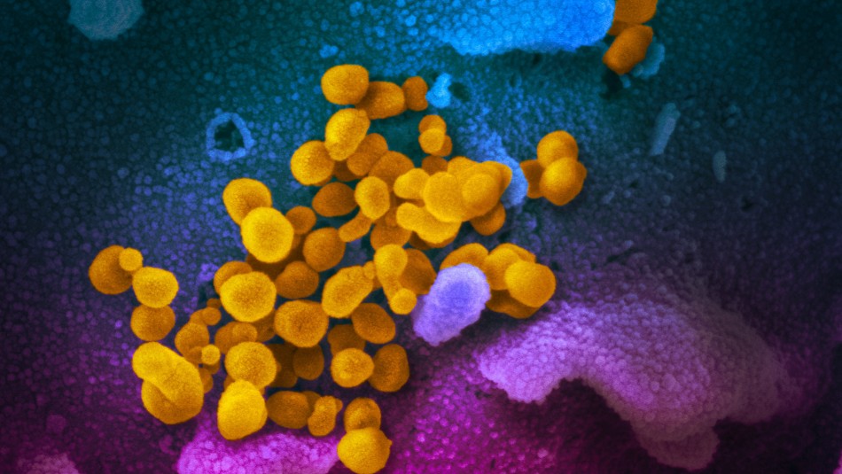 Primeras imágenes del SARS-CoV-2 Científicos alertan sobre nuevas mutaciones del coronavirus: Podría evadir inmunidad