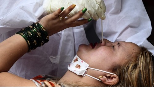 Test de coronavirus causó fuga de líquido cerebral en paciente con afección poco común en EEUU