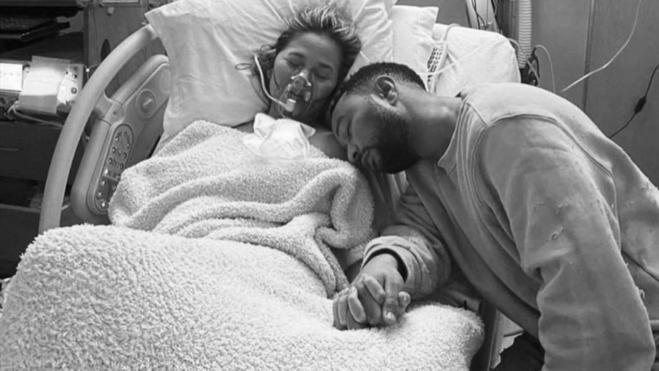 Chrissy Teigen Chrissy Teigen