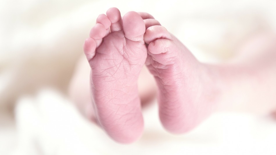Celebran primer cumpleaños del bebé sin rostro: Celebran primer cumpleaños del bebé sin rostro: