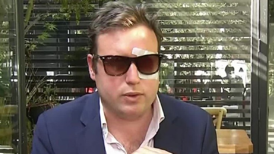 El empresario Max Raide Formalizan a jóvenes por golpiza a empresario: Uno quedó en prisión por condena anterior
