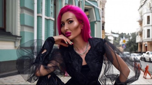 Las impresionantes imágenes de la mujer con 'las mejillas más grandes del mundo'