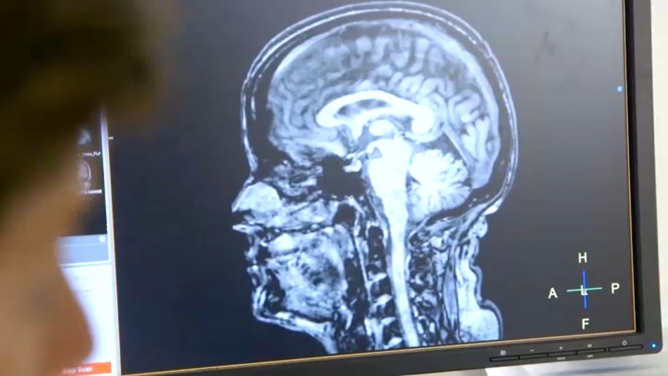 El coronavirus podría envejecer el cerebro hasta en 10 años El coronavirus podría envejecer el cerebro hasta en 10 años