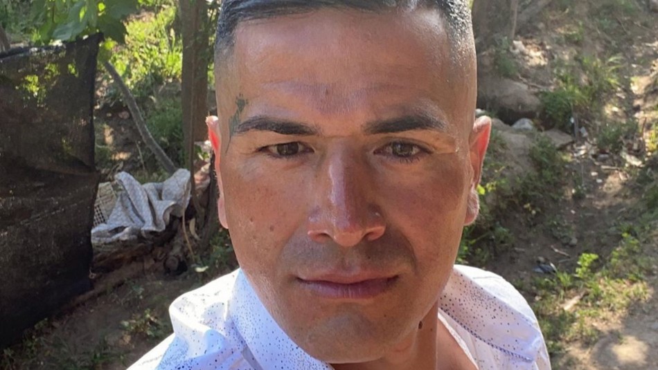Kike Acuña Kike Acuña se aplica botox en el rostro para suavizar arrugas: