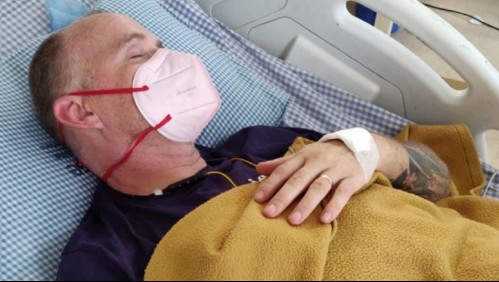 Antes tuvo coronavirus, dengue y malaria: Hombre logra sobrevivir a la mordedura de una cobra