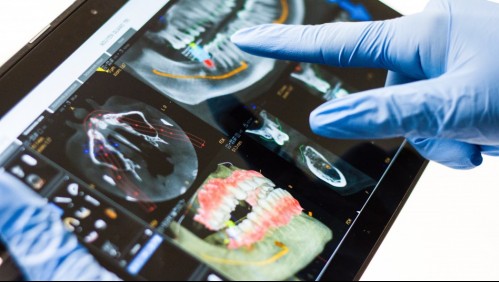 Las ventajas de la 'Odontología Digital' en pandemia: Tratamientos más precisos y rápidos
