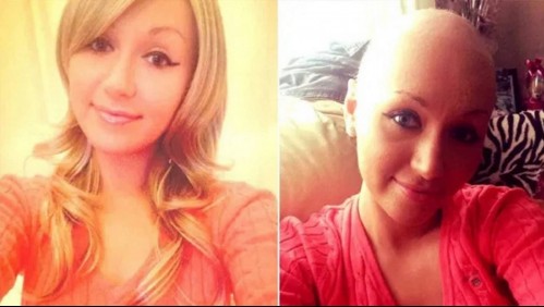 Murió de cáncer a los 23 años luego que le negaron 15 veces un examen