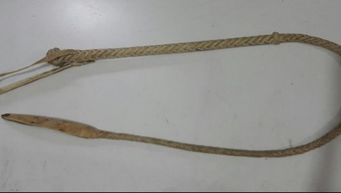 Niña de cuatro años recibe brutal golpiza de su padre con un látigo