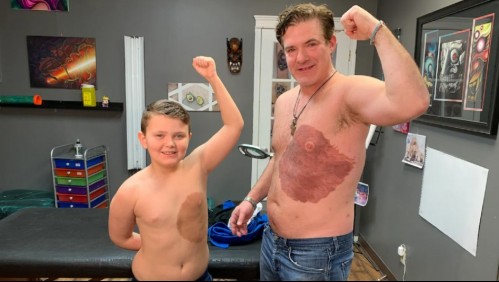 Padre se vuelve viral al tatuarse la misma marca de nacimiento que tanto atormenta a su hijo