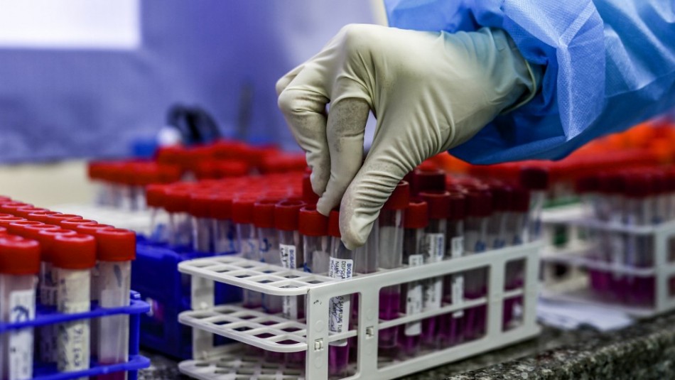 Imagen referencial de archivo Estudio afirma que nueva cepa del coronavirus es hasta un 74% más contagiosa