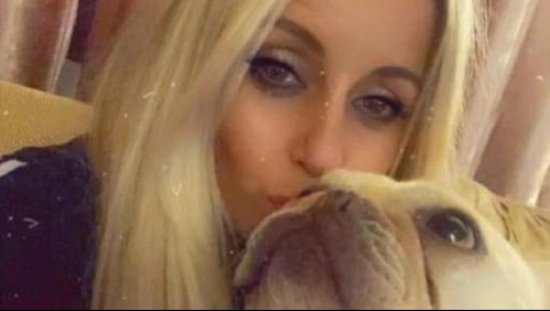 Madre mordida por un perro vive dramático momento: Perdió su mano y entró en coma