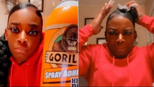 Peinó su cabello con pegamento y ahora ruega por dinero para operarse