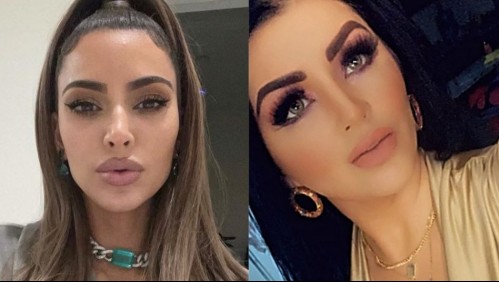 La 'Kim Kardashian mexicana' revela a cuáles y a cuántas cirugías se ha sometido