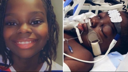 Niño de 10 años contrae coronavirus: Le amputaron brazos y piernas al desarrollar raro síndrome