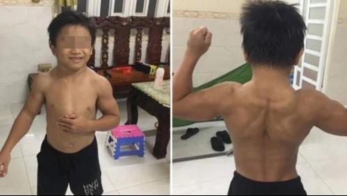 Un niño de 10 años tiene cuerpo de fisicoculturista por una rara enfermedad