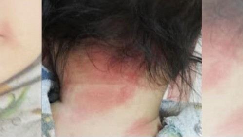 Mamá de bebé rociado con gas pimienta en Bajos de Mena: 'Pensé que iba a morir'