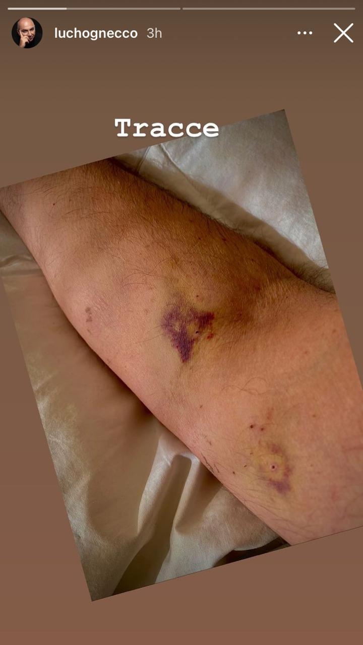 Historia de Luis Gnecco