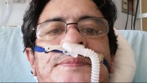 'Murió por cuidar imbéciles': Médico muere y su hermano critica a quienes no se cuidan