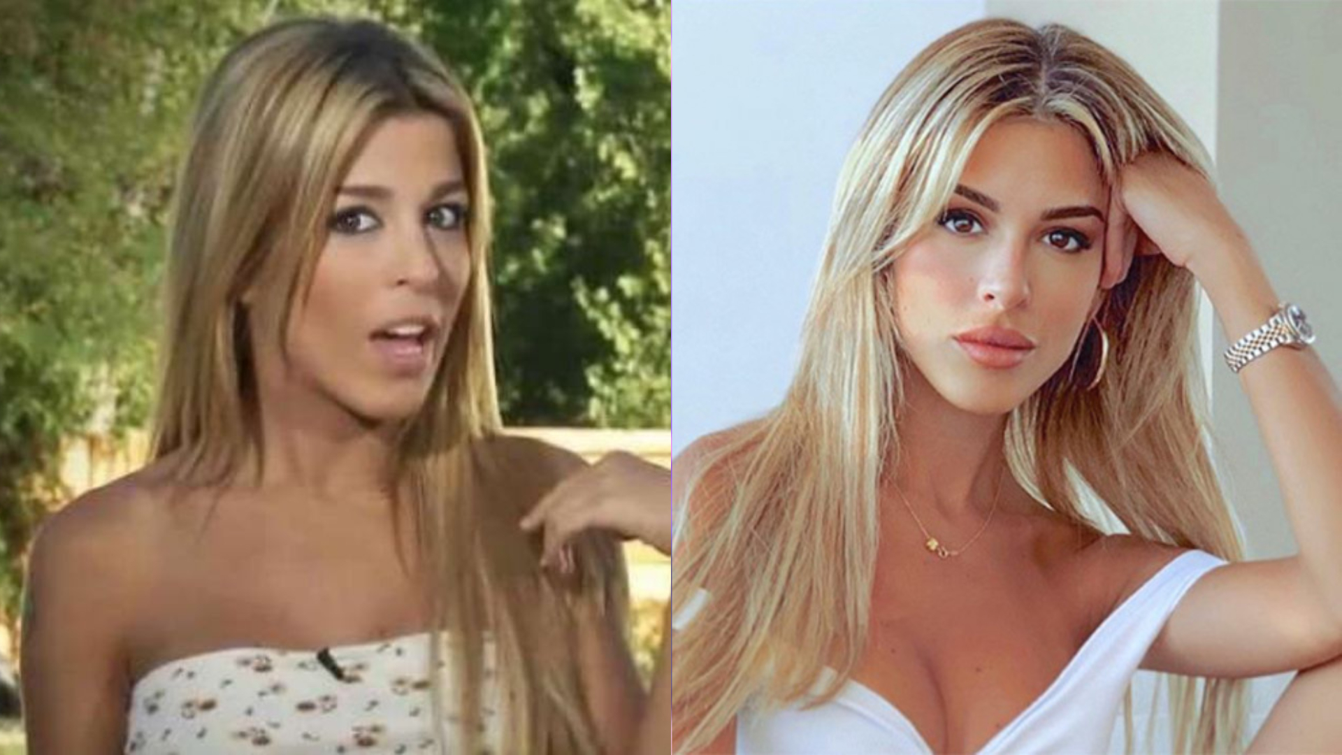 Oriana Marzoli antes y después de operarse los labios