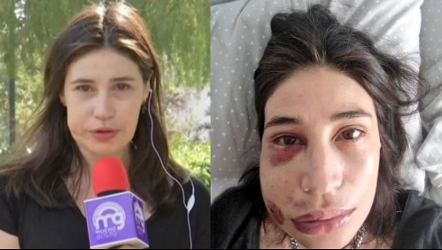 Arresto domiciliario nocturno para carabinero acusado de disparar a actriz María Paz Grandjean