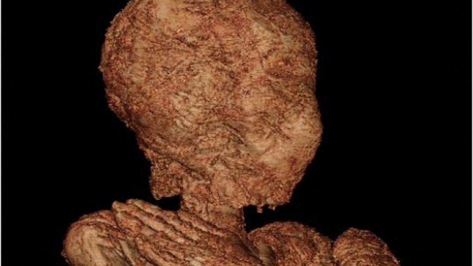 momia-embarazada Inédito hallazgo: científicos publican fotos de una momia egipcia embarazada