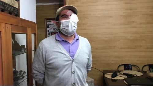 Candidato a concejal por Quinta Normal denuncia haber recibido impacto de balín en ojo izquierdo
