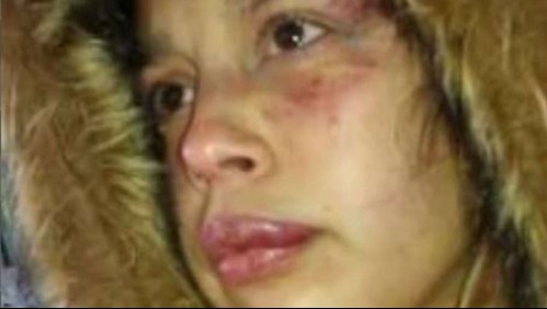 'Te dejo descansar dos semanas y después te voy a matar': mujer denuncia agresiones de pareja