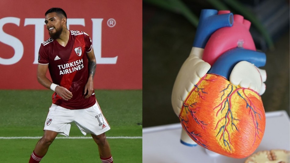 Miocarditis post covid-19: La secuela que afecta al futbolista Paulo Díaz Miocarditis post covid-19: La secuela que afecta al futbolista Paulo Díaz