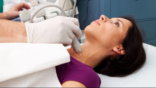 Problemas en la tiroides: Revisa qué síntomas podrían indicar problemas