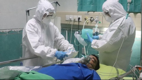 'Hongo negro' llega a Uruguay: reportan primer caso de la infección relacionada al Covid-19