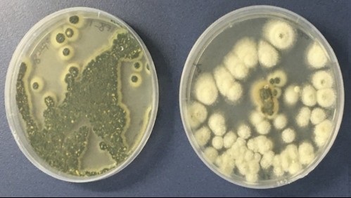 Las diferencias entre el 'hongo negro' y el 'hongo verde' asociados al Covid-19