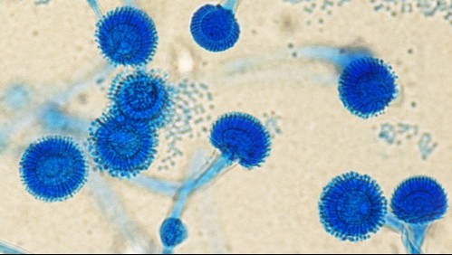 'Hongo Verde': ¿Cómo se contagia la enfermedad asociada al Covid que fue detectada en Chile?