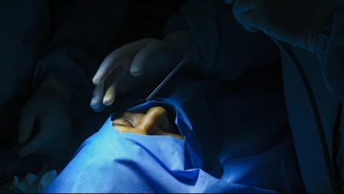 'Hongo Negro': Así se contagia la enfermedad asociada al Covid que fue detectada en Chile