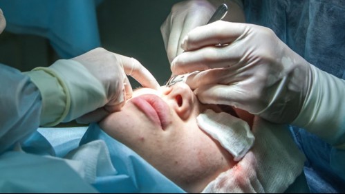 Publican imágenes de hombre afectado por 'hongo negro': así avanza la enfermedad