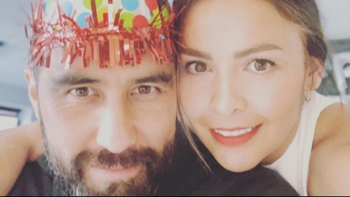 En Instagram afirman que Carla Pardo se retocó los labios: Así respondió esposa de Claudio Bravo