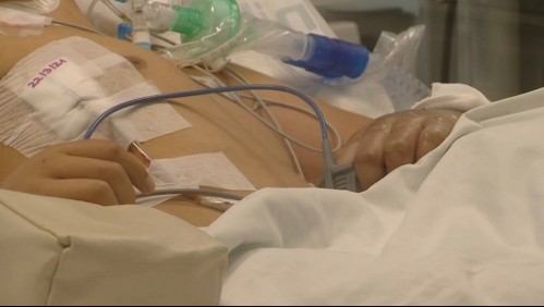 Los complejos efectos del Covid en pacientes sub 40