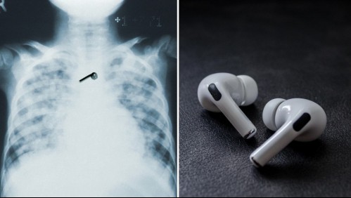 Hombre se queda dormido y se traga uno de sus AirPods: Los audífonos aún funcionan